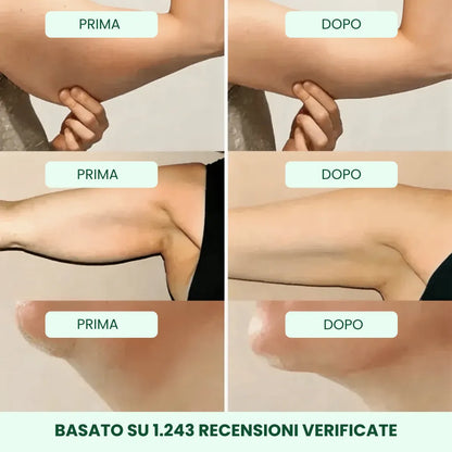 Drenaggio Linfatico