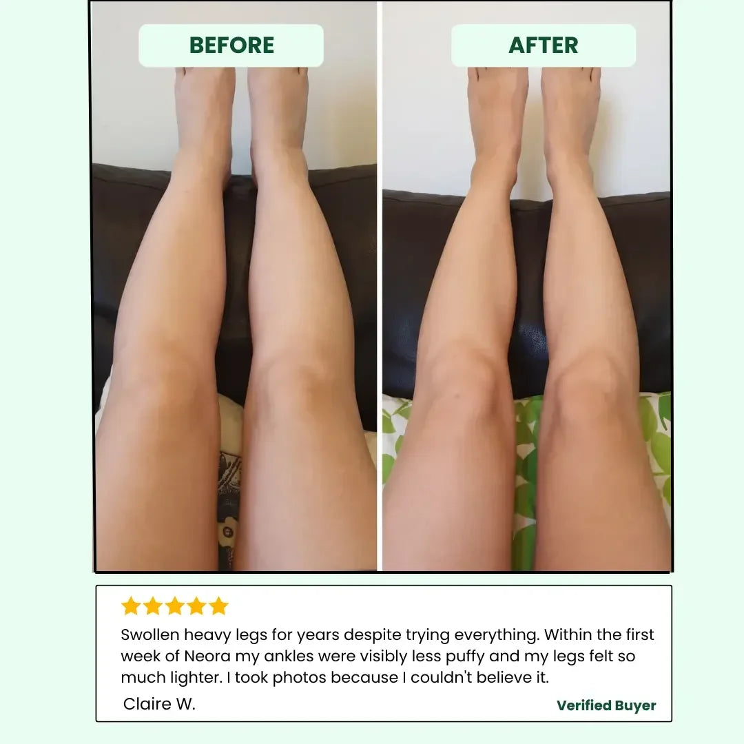 Lymphatic Drainage Drops
